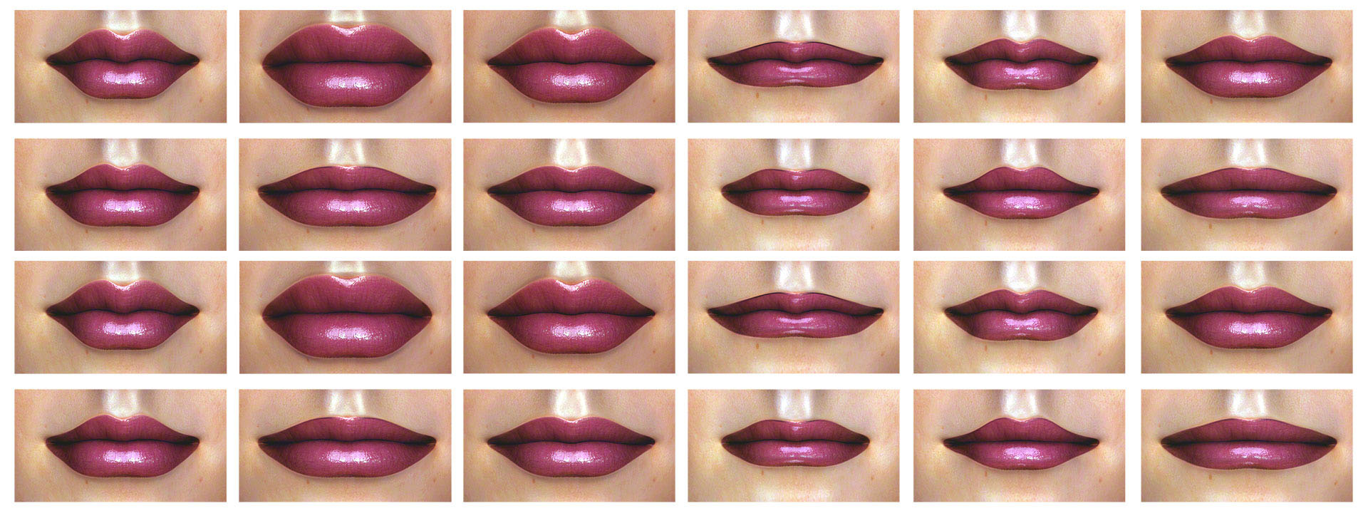 Lippenvergrößerung Lippenkorrektur
